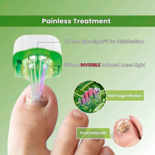 Fungiclear- Nail Fungus Laser
