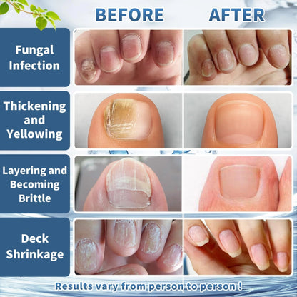 Nail Repair Drops