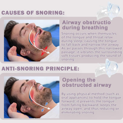 Anti Snore Mouth Guard
