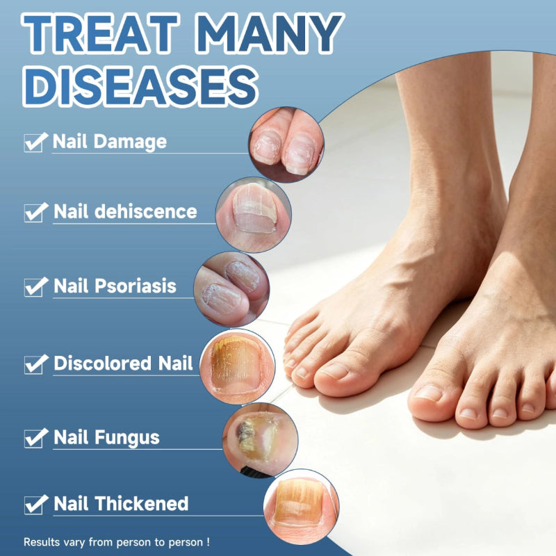 Nail Repair Drops