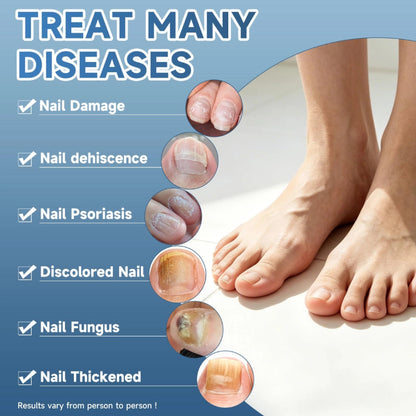 Nail Repair Drops