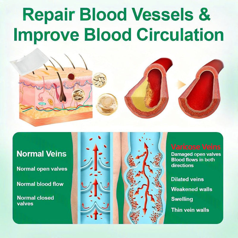 Varicose Vein Relief Microneedle Patch